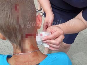 В Каменске-Шахтинском бродячая собака напала на школьника