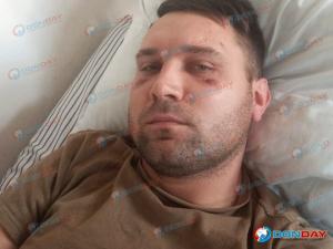 В Ростовской области мобилизовали мужчину с кистой головного мозга