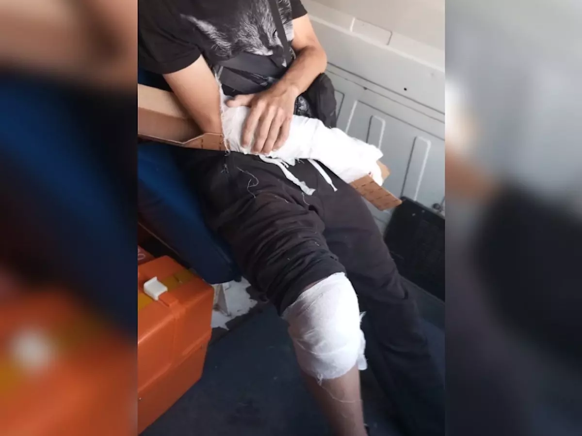 В Ростове мать пострадавшего 16-летнего мотоциклиста ищет свидетелей ДТП