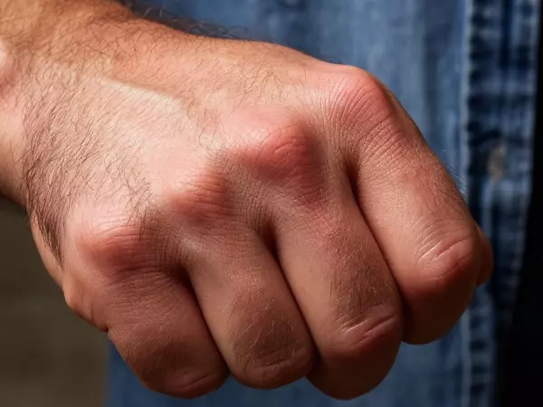 В Ростове 17-летний юноша попал в больницу после потасовки на улице