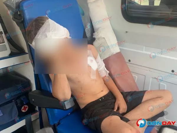 Фото к материалу: В Ростовской области волк напал на 8-летнего мальчика