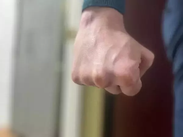 В Зверево во время ссоры подросток жестоко избил  33-летнего знакомого