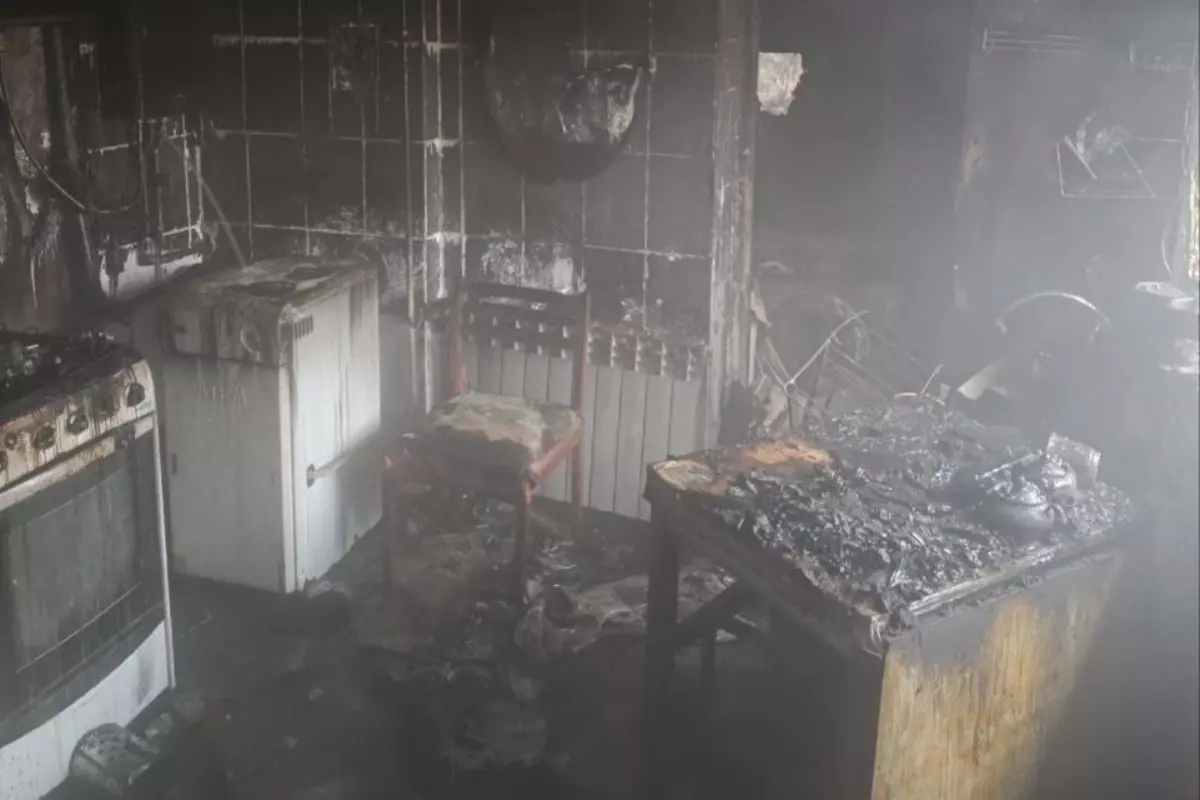 В Ростовской области пенсионер получил ожоги при пожаре