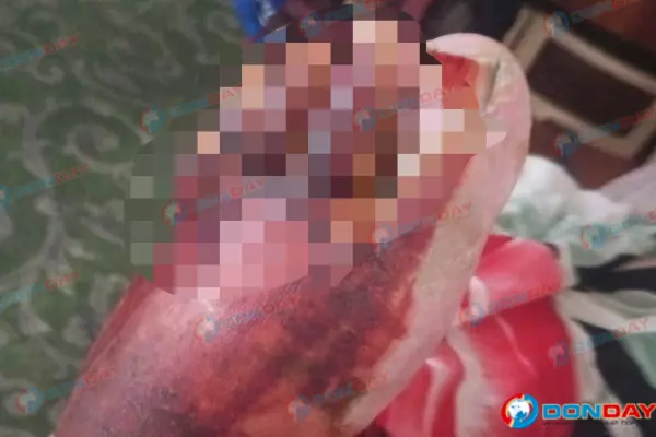 Фото к материалу: Житель Новочеркасска три месяца добивается возбуждения дела после уличной драки