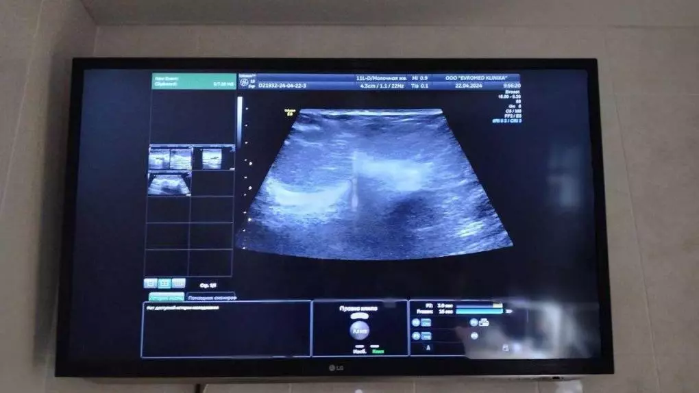 После гибели младенцев в Новокузнецке «Союз отцов» призывает мужчин Новосибирска активно участвовать в беременности и родах