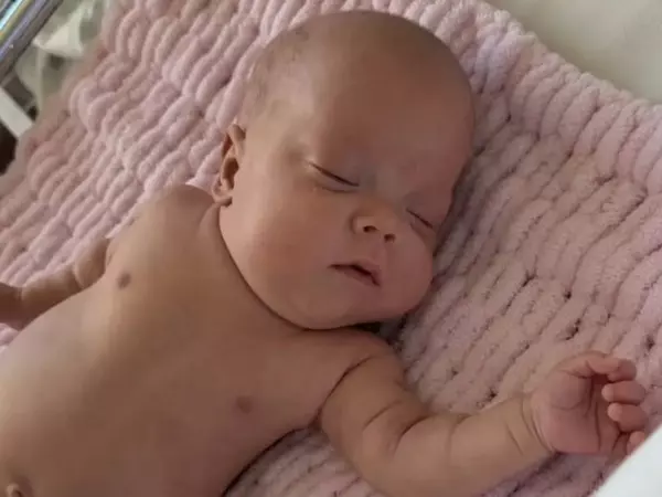 Фото к материалу: Ростовские врачи спасли новорожденную весом 580 граммов