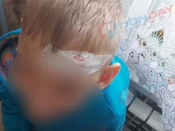 Фото к материалу: В Цимлянске ребенку с пробитой головой не смогли помочь из-за отсутствия дежурного  хирурга