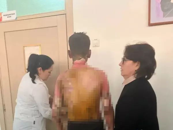 Фото к материалу: В Красноярске школьница облила одноклассника бензином и подожгла