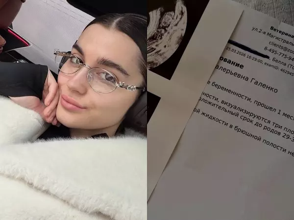 Фото к материалу: Беременность – один месяц: MONA шокировала поклонников снимками УЗИ