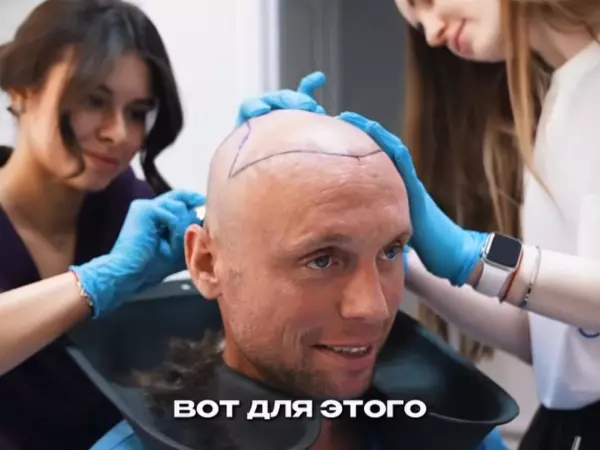 Фото к материалу: Донской экс-футболист Денис Глушаков сделал пересадку волос