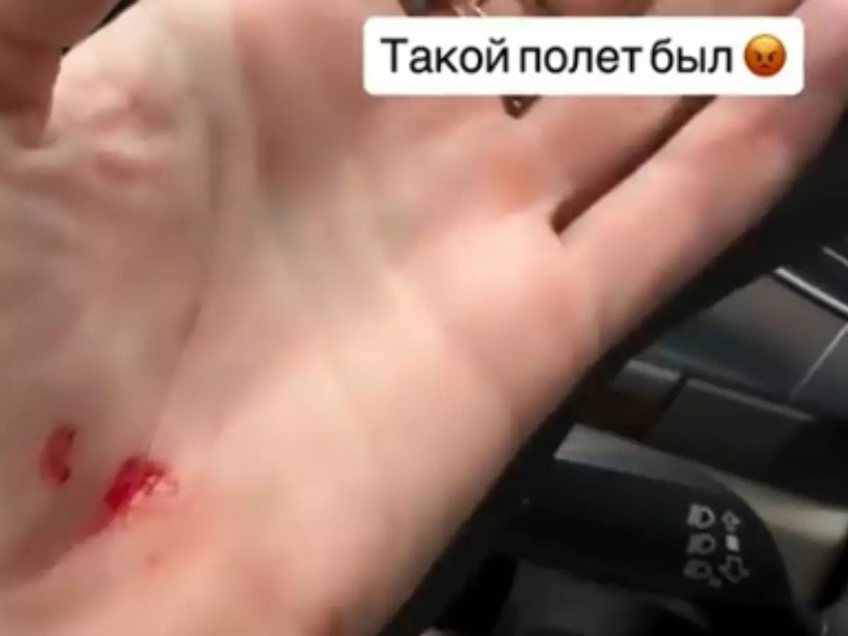 Полина Диброва упала и получила травму